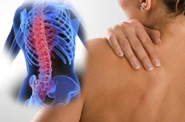 During an exacerbation of osteochondrosis of the thoracic spine, dorsago pain occurs
