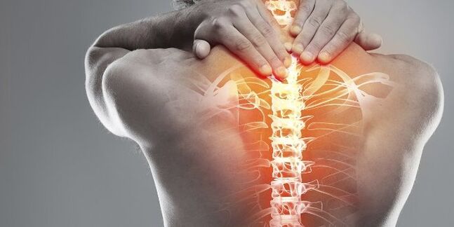 Medical options for cervical therapy of cervical osteocondrosis