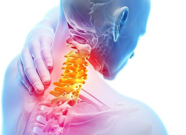 Symptoms and stages of the development of cervical osteocondrosis