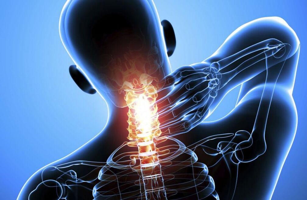 Osteochondrosis of cervical spine