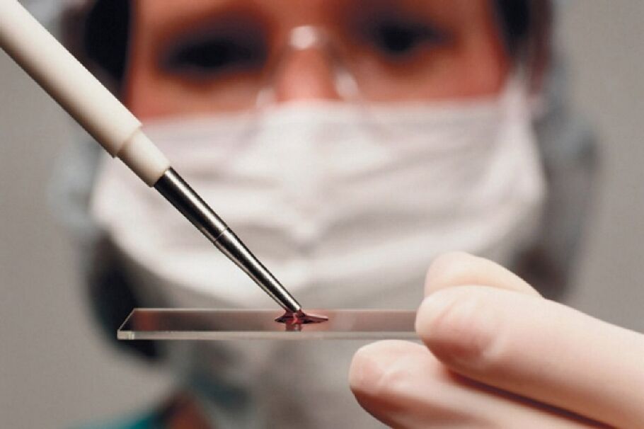 Gout is an inflammatory disease and its presence is revealed by blood tests.